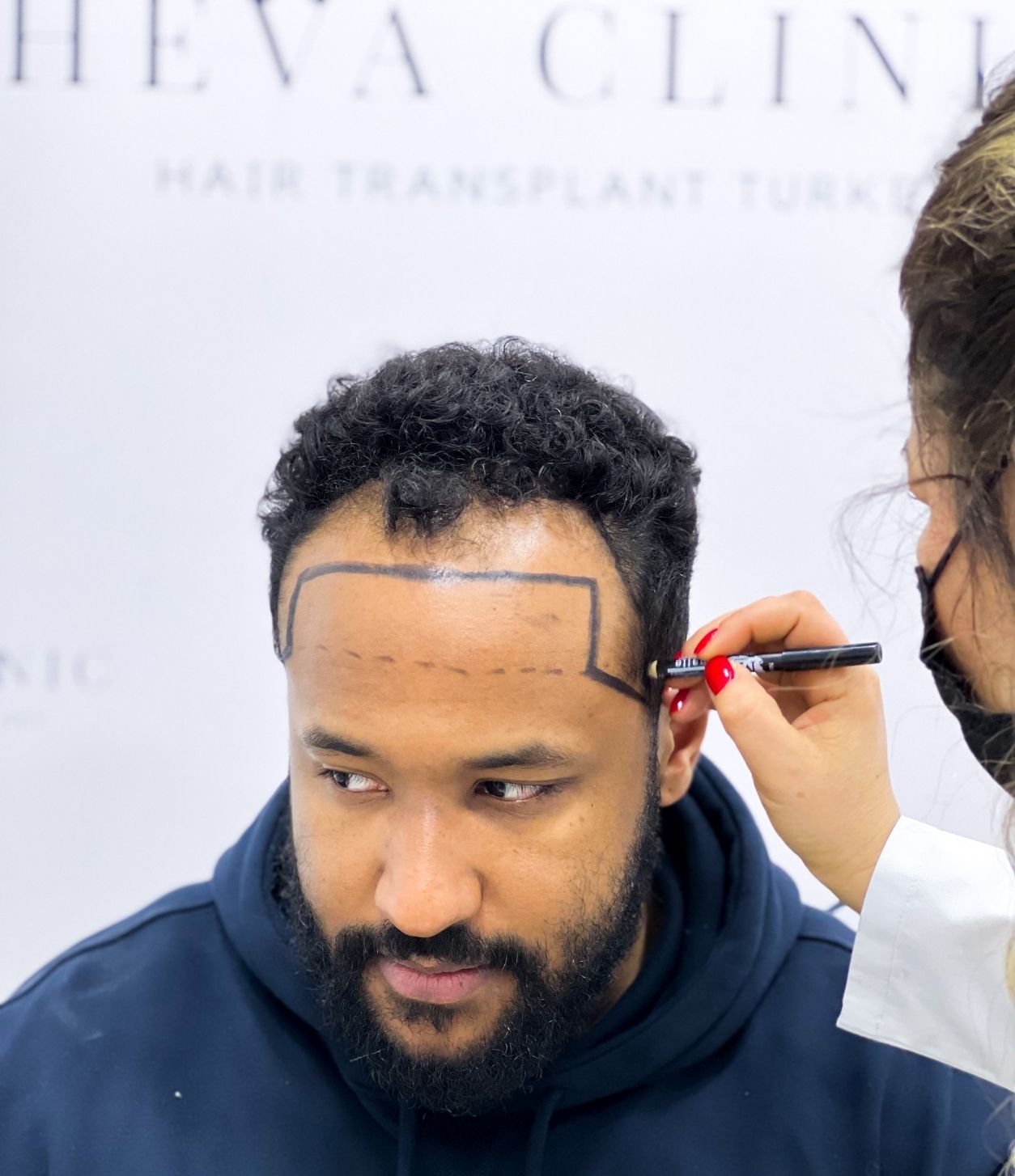 Your Personal Hair Transplant Journey