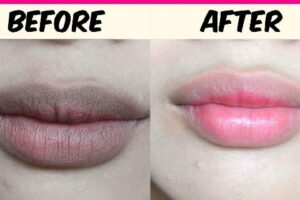 How to Get Pink Lips Naturally in Nigeria
